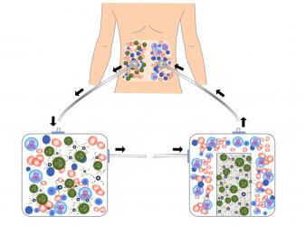 Drugscomhealth Guidenon Small Cell Lung Cancer 