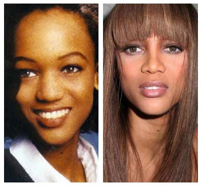 Tyra Banks Nose Job If we look the before and after pictures any one can 