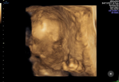 This 3D ultrasound is the closest we got to see our baby's cute face. I love his little nose and fingers.