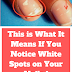 This Is What It Means If You Notice White Spots On Your Nails ! 