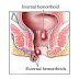 Obat Ambeien Kaskus thumbnail