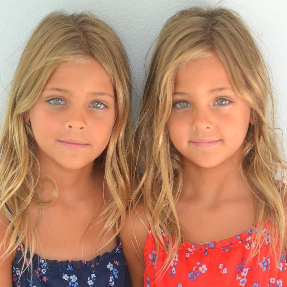 This Is What The World’s Most Beautiful Twins Look Like Today