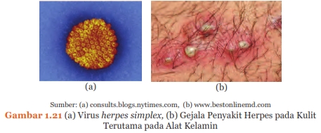 Sistem Reproduksi pada Manusia, http://semuamaterisekolah.blogspot.co.id/