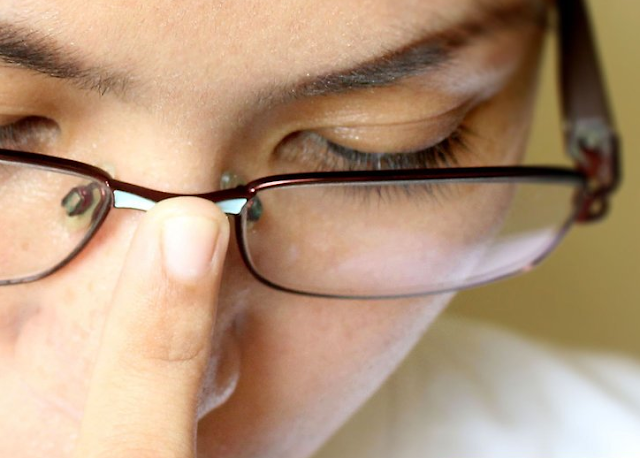 Eliminate Dents on Nose from Glasses