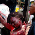 Very graphic photos of victims of Borno Bomb blast