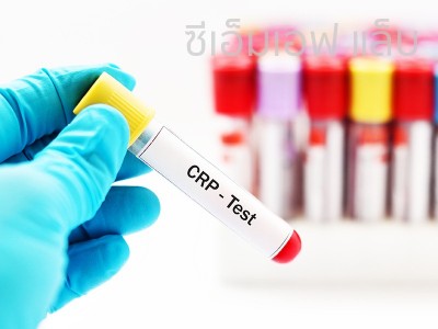 Apa Itu Tes C-Reaktif Protein (CRP) Tes Darah untuk Memeriksa Peradangan