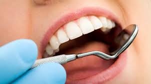 best dental implant Melbourne - captivate dental