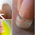 Attention! Don't Worry If Your Nails Look Fragile And Brittle, See This Below!