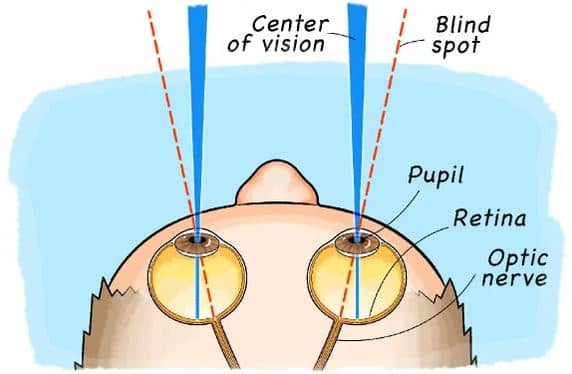 fungsi bintik buta pada mata dan mengapa titik tanpa penglihatan ini merupakan bagian yang menarik dalam sistem penglihatan manusia.