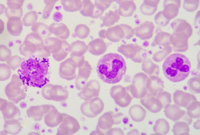 What are Neutrophils in The Blood.