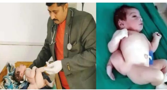 OMG  बिहार में महिला ने तीन पैर वाले बच्चे को दिया जन्म