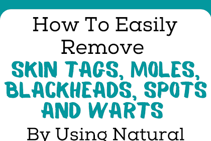 How To Easily Remove Skin Tags, Moles, Blackheads, Spots And Warts By Using Natural Remedies