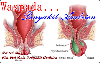 obat ambeien untuk pria dan wanita paling ampuh di apotik