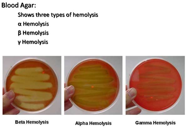 CAMP test showing half-moon shaped zone of complete hemolysis on a