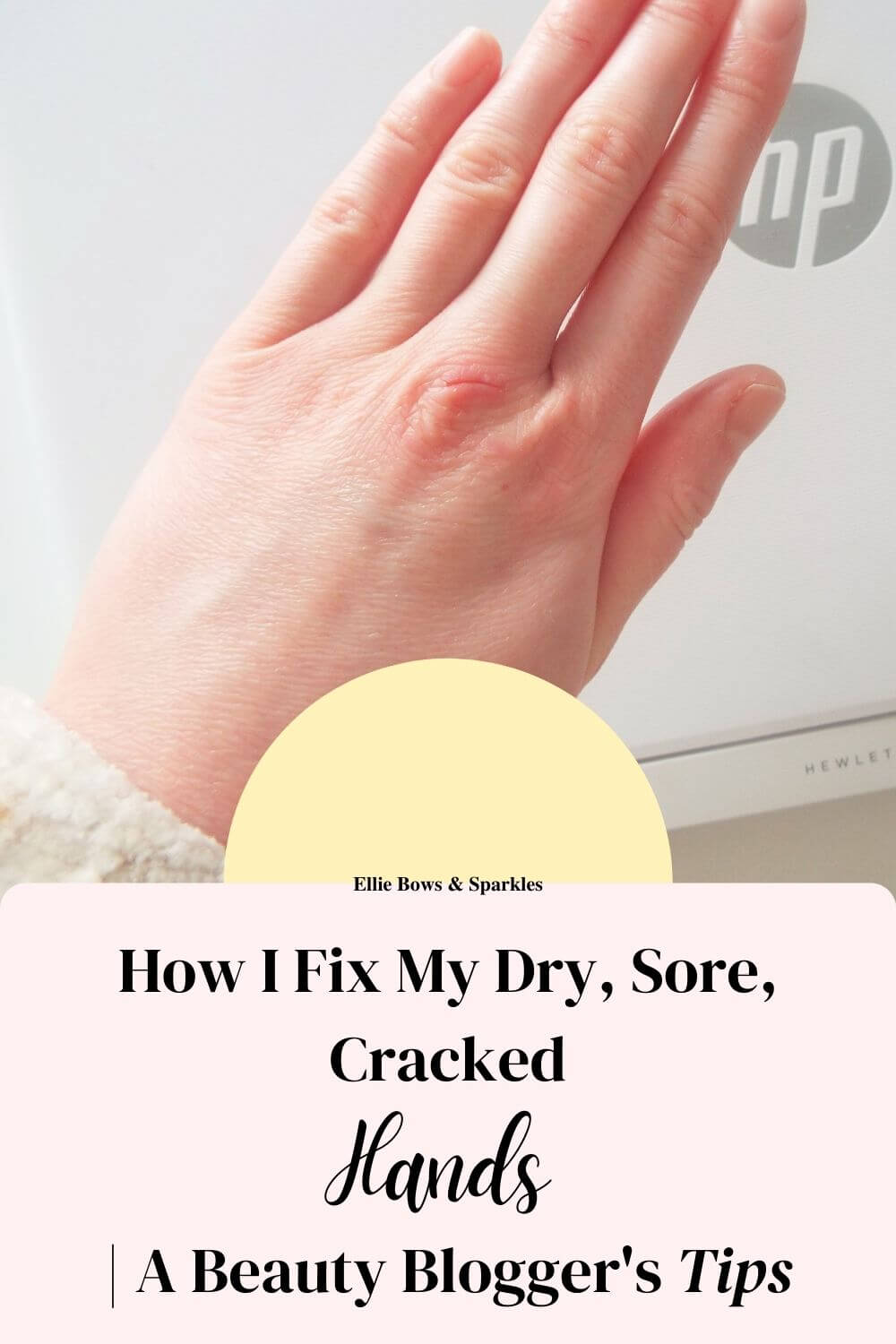 Pinterest pin, with large picture of my dry, sore, cracked hands; pink title card to bottom and bold black and handwritten font, reading "How I Fix My Dry, Sore, Cracked Hands | A Beauty Blogger's Tips". A pastel yellow semi-circle sits on top, featuring the blog URL.