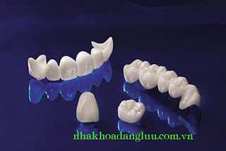 Ưu điểm của phương pháp phục hình răng sứ zirconia