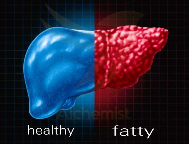 fatty liver,fatty liver disease,fatty liver diet,fatty liver symptoms,fatty liver treatment,nonalcoholic fatty liver disease,fatty liver causes,non-alcoholic fatty liver disease,fatty liver home remedies,what is fatty liver,fatty liver exercise,symptoms of fatty liver,what causes fatty liver,what is a fatty liver,non alcoholic fatty liver disease,fatty liver cure,fatty liver disease treatment,fatty liver repair,symptoms of fatty liver disease,liver,food,street food,food insider,best ever food review show,fast food,asian food,exotic food,food wars,food tour,trini food,korean food,indian food,best food,food blog,spicy food,south east asian food,comfort food,amsterdam food,big food,trini street food,foodie,indian street food,street food videos,rare food,thai food,mini food,tiny food,iraq food,food vlog