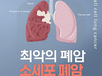폐암 중에 가장 무서운 폐암-소세포폐암 그리고 한의학