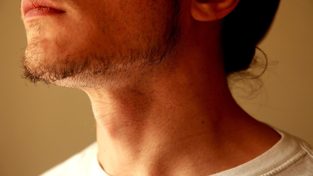 How To Remove Ingrown Hairs On Face