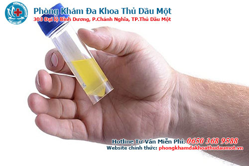 Nước tiểu nhiều bọt có sao không?