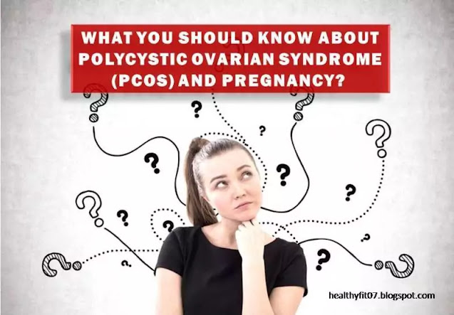 POLYCYSTIC OVARY SYNDROME