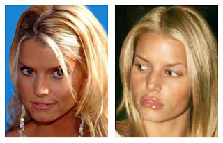 Jessica-Simpson-Plastic-Surgery-gone-bad-before-after