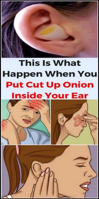 This Is What Happen When You Put Cut Up Onion Inside Your Ear