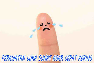 luka sunat cepat