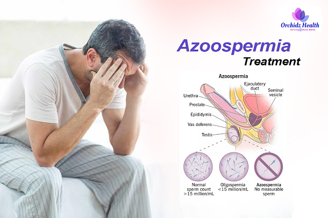 azoospermia_treatment