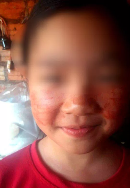 11-YEAR-OLD SCHOOLGIRL SWEETS BLOOD AS PREPARES FOR EXAM [PHOTOS]