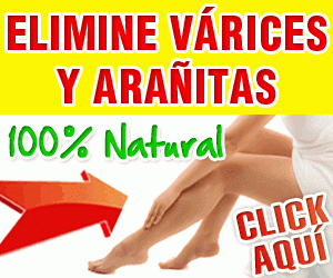 como disminuir las varices de forma natural