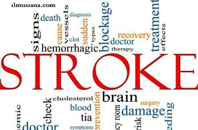  Ternyata yang namanya racun itu tidak selalu menjadi musuh manusia Racun ini Ampuh Obati Stroke & Epilepsi