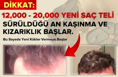 http://www.tikucuz.com/vusla-karasarimsak-sampuani.html