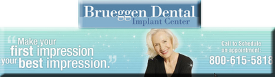 Dental implants