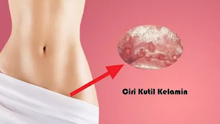 Alamat Penjual Obat Kutil Kelamin di Apotik Terdekat di Palangka Raya