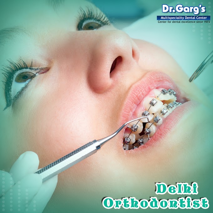 Which Delhi Orthodontist is Right for You?