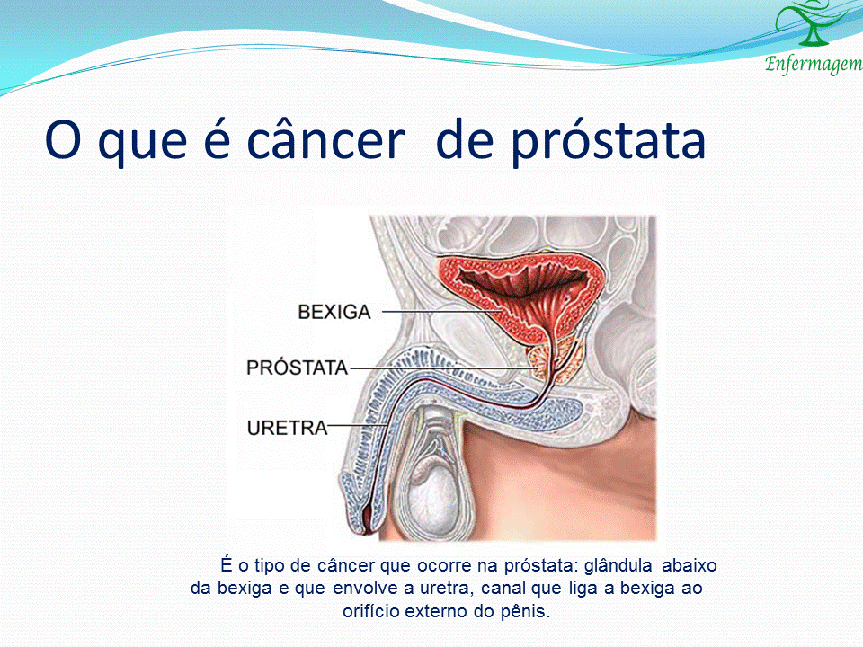 JA Serviços Gráficos: câncer de próstata por José Aldo