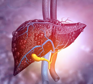 MIT engineers developed diagnostic tool Sensor can detect scarred or fatty liver tissue