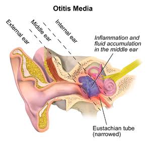 Pharmacotherapy of otitis media and otitis external