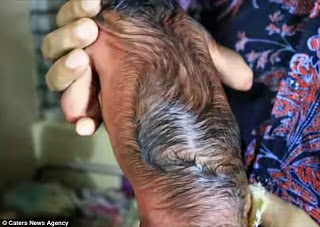 A Baby Has Been Born That Looks Like A 80-Year-Old Man (PHOTOS)