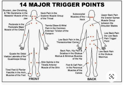 illnesses that are treated by cupping therapy