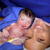 Teste da linguinha em recém-nascidos passa a ser obrigatório