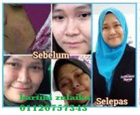 cara jaga wajah, kepentingan jaga wajah, cara jaga wajah untuk jelita, kejelitaan wajah dengan cara yang betul, kecantikan luar dan dalam, tip cantik luar dalam , cara mudah untuk cantik, cara jaga wajah dengan betul , pengedar shaklee perlis, shaklee kangar, pengedar shaklee arau , cod vitamin shaklee, cod vitamin shaklee arau , cod vitamin shaklee perlis, 