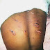 Guardian beat up 15-year old girl for sending daughter on an errand