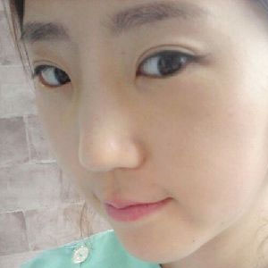 짱이뻐! - Give Up On Highlighter, I Decided To Do Nose Surgery