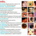 Ophthalmic manifestations in Diseases