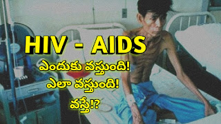 HIV - AIDS గురించి పూర్తి సమాచారం | Complete History of HIV AIDS in Telugu