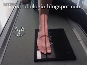Posicionamento radiológico, raio x de pé, rx pe, radiografia do pé