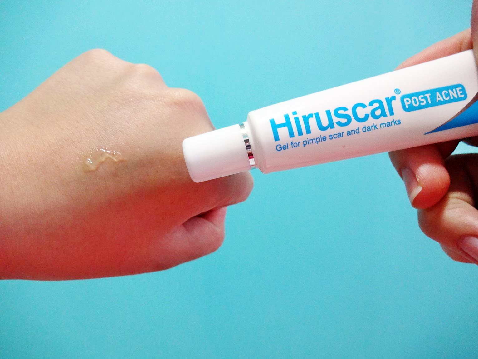 mshuiling : Review: Hiruscar Post Acne