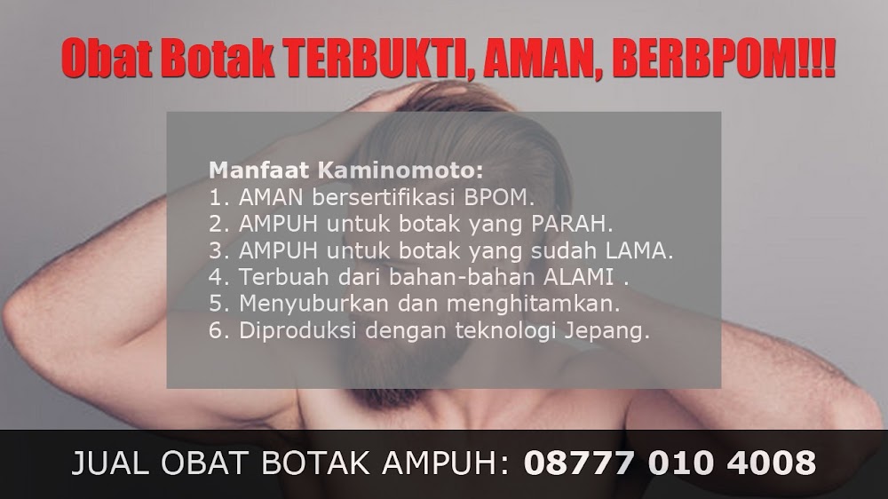 jual OBAT PENUMBUH RAMBUT BOTAK Padang Lawas<br/>